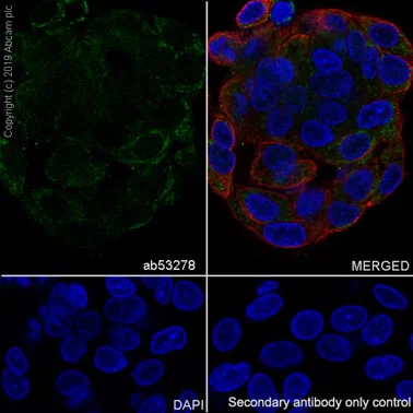 Immunocytochemistry/ Immunofluorescence - Anti-ALDH7A1 antibody [EP1935Y] (AB53278)