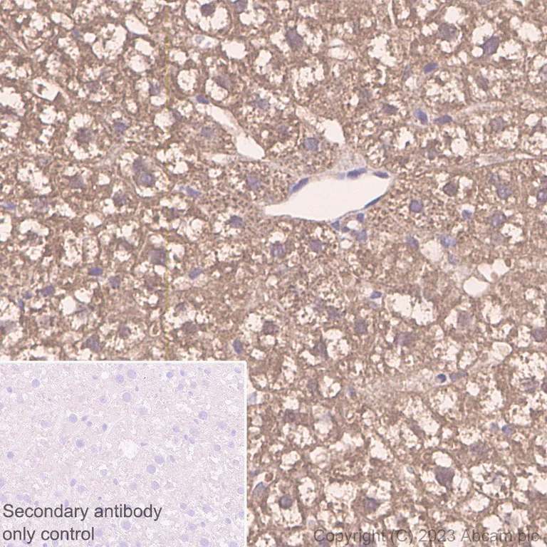Immunohistochemistry (Formalin/PFA-fixed paraffin-embedded sections) - Anti-ALDH7A1 antibody [EP1935Y] (AB53278)