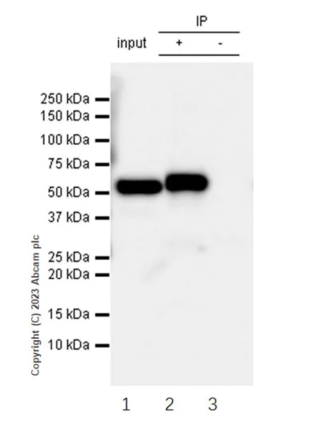 Immunoprecipitation - Anti-ALDH7A1 antibody [EP1935Y] (AB53278)
