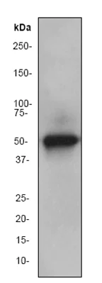 Western blot - Anti-ALDH7A1 antibody [EP1935Y] (AB53278)