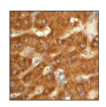 Immunohistochemistry (Formalin/PFA-fixed paraffin-embedded sections) - Anti-ALDH7A1 antibody [EP1935Y] - BSA and Azide free (AB284700)
