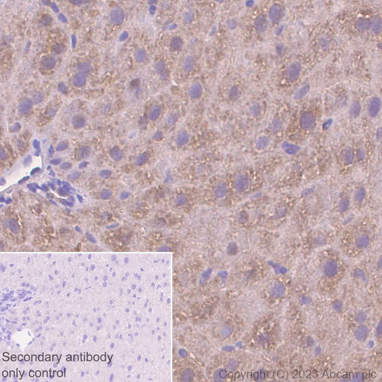 Immunohistochemistry (Formalin/PFA-fixed paraffin-embedded sections) - Anti-ALDH7A1 antibody [EP1935Y] - BSA and Azide free (AB284700)