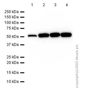 Western blot - Anti-ALDH7A1 antibody [EP1935Y] - BSA and Azide free (AB284700)