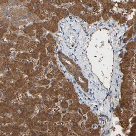 Immunohistochemistry (Formalin/PFA-fixed paraffin-embedded sections) - Anti-ALDH9A1 antibody (AB224360)