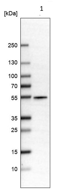Western blot - Anti-ALDH9A1 antibody (AB224360)
