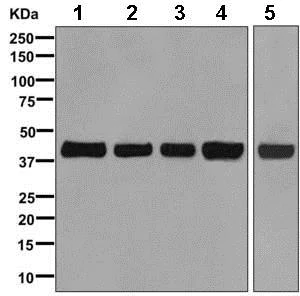 Western blot - Anti-Aldolase + Aldolase B + Aldolase C antibody [EPR9724(B)] (AB169544)