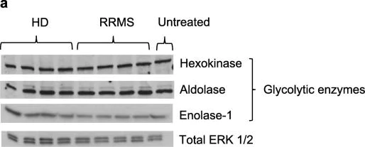 Western blot - Anti-Aldolase + Aldolase B + Aldolase C antibody [EPR9724(B)] (AB169544)