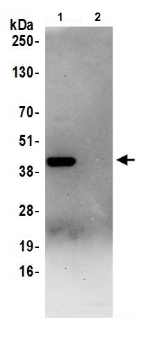 Immunoprecipitation - Anti-Aldolase antibody (AB245469)