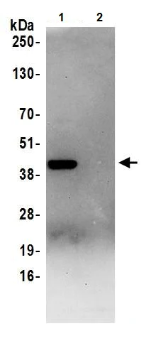 Immunoprecipitation - Anti-Aldolase antibody (AB245469)