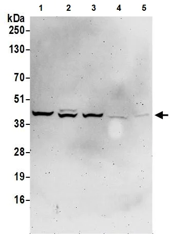 Western blot - Anti-Aldolase antibody (AB245469)