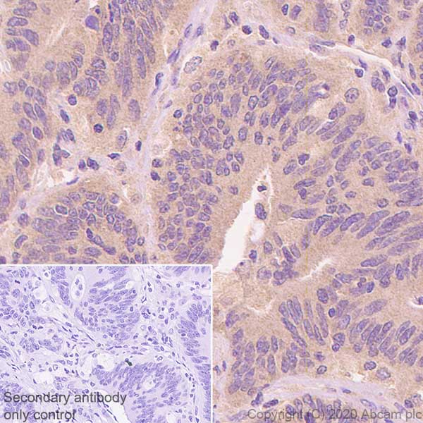 Immunohistochemistry (Formalin/PFA-fixed paraffin-embedded sections) - Anti-Aldolase antibody [EPR23181-39] (ab252953), expandable thumbnail
