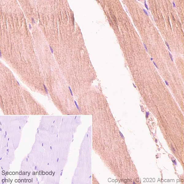 Immunohistochemistry (Formalin/PFA-fixed paraffin-embedded sections) - Anti-Aldolase antibody [EPR23181-39] (AB252953)