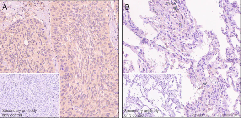 Immunohistochemistry (Formalin/PFA-fixed paraffin-embedded sections) - Anti-Aldolase antibody [EPR23181-39] (AB252953)