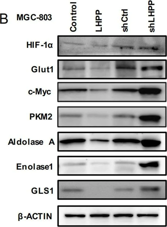Western blot - Anti-Aldolase antibody [EPR23181-39] (AB252953)