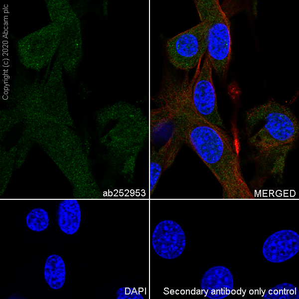 Immunocytochemistry/ Immunofluorescence - Anti-Aldolase antibody [EPR23181-39] - BSA and Azide free (ab273636), expandable thumbnail