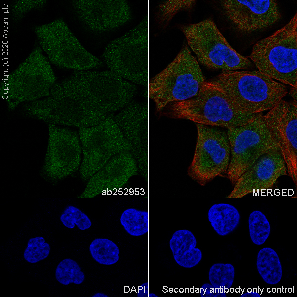 Immunocytochemistry/ Immunofluorescence - Anti-Aldolase antibody [EPR23181-39] - BSA and Azide free (AB273636), expandable thumbnail