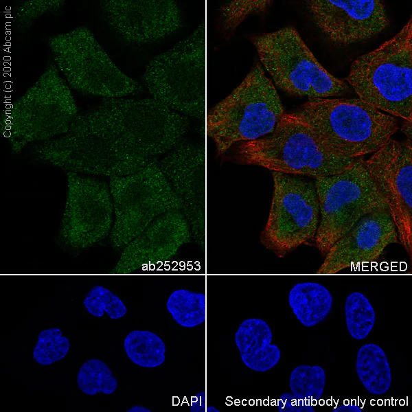 Immunocytochemistry/ Immunofluorescence - Anti-Aldolase antibody [EPR23181-39] - BSA and Azide free (AB273636)