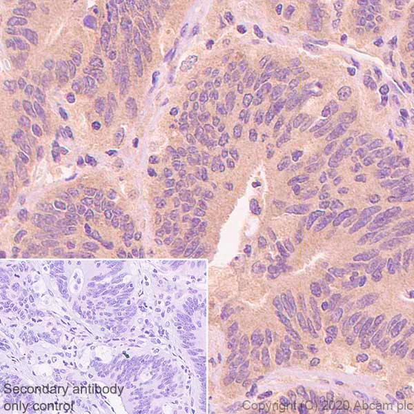 Immunohistochemistry (Formalin/PFA-fixed paraffin-embedded sections) - Anti-Aldolase antibody [EPR23181-39] - BSA and Azide free (AB273636)