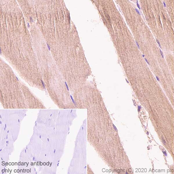 Immunohistochemistry (Formalin/PFA-fixed paraffin-embedded sections) - Anti-Aldolase antibody [EPR23181-39] - BSA and Azide free (ab273636), expandable thumbnail