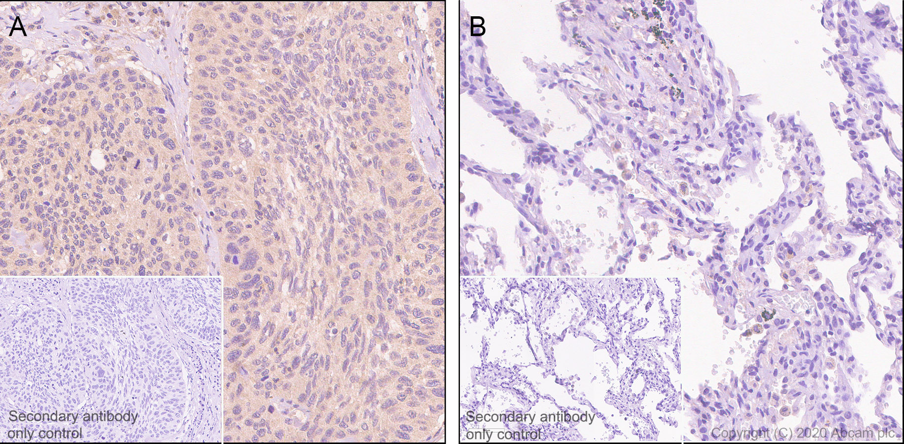 Immunohistochemistry (Formalin/PFA-fixed paraffin-embedded sections) - Anti-Aldolase antibody [EPR23181-39] - BSA and Azide free (ab273636), expandable thumbnail