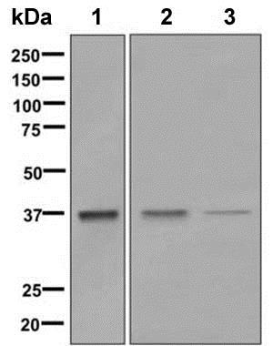 Western blot - Anti-Aldolase antibody [EPR9725] (AB150396)