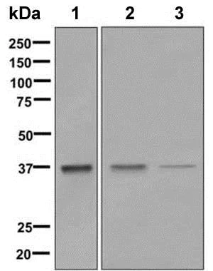 Western blot - Anti-Aldolase antibody [EPR9725] (AB150396)