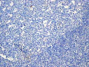 Immunohistochemistry (Formalin/PFA-fixed paraffin-embedded sections) - Anti-Aldolase B + Aldolase C antibody [EPR3137] (AB133333), expandable thumbnail