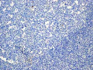 Immunohistochemistry (Formalin/PFA-fixed paraffin-embedded sections) - Anti-Aldolase B + Aldolase C antibody [EPR3137] (AB133333)
