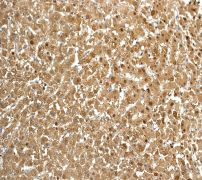 Immunohistochemistry (Formalin/PFA-fixed paraffin-embedded sections) - Anti-Aldolase B + Aldolase C antibody [EPR3137] (AB133333), expandable thumbnail