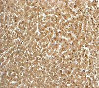 Immunohistochemistry (Formalin/PFA-fixed paraffin-embedded sections) - Anti-Aldolase B + Aldolase C antibody [EPR3137] (AB133333)