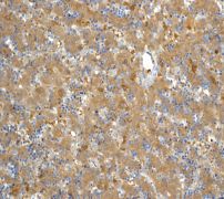 Immunohistochemistry (Formalin/PFA-fixed paraffin-embedded sections) - Anti-Aldolase B + Aldolase C antibody [EPR3137] (AB133333), expandable thumbnail