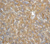 Immunohistochemistry (Formalin/PFA-fixed paraffin-embedded sections) - Anti-Aldolase B + Aldolase C antibody [EPR3137] (AB133333)