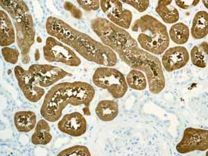 Immunohistochemistry (Formalin/PFA-fixed paraffin-embedded sections) - Anti-Aldolase B + Aldolase C antibody [EPR3137] (ab133333), expandable thumbnail