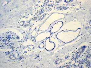 Immunohistochemistry (Formalin/PFA-fixed paraffin-embedded sections) - Anti-Aldolase B + Aldolase C antibody [EPR3137] (AB133333)