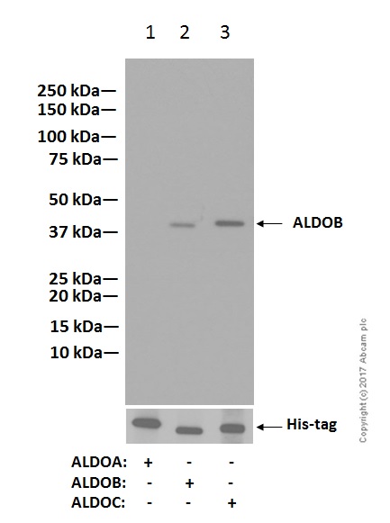 Western blot - Anti-Aldolase B + Aldolase C antibody [EPR3137] (AB133333), expandable thumbnail