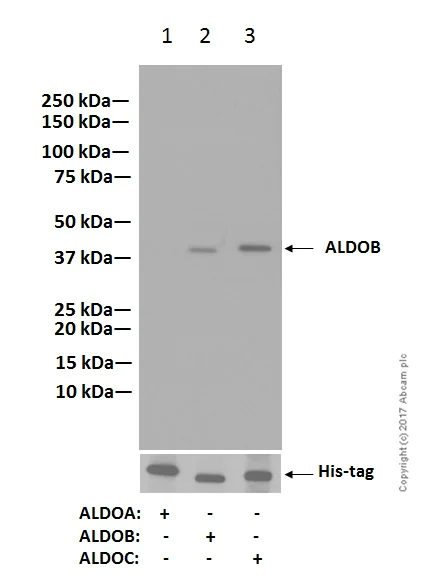 Western blot - Anti-Aldolase B + Aldolase C antibody [EPR3137] (AB133333)