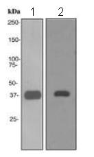 Western blot - Anti-Aldolase B + Aldolase C antibody [EPR3137] (AB133333), expandable thumbnail
