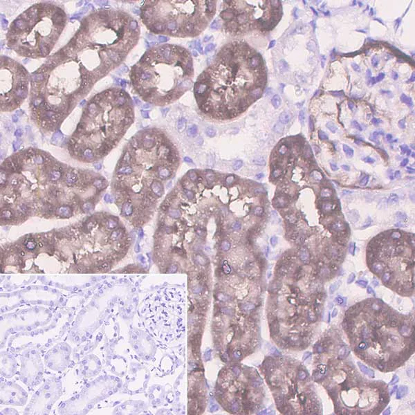 Immunohistochemistry (Formalin/PFA-fixed paraffin-embedded sections) - Anti-Aldolase B + Aldolase C antibody [EPR3138Y] (AB75751)