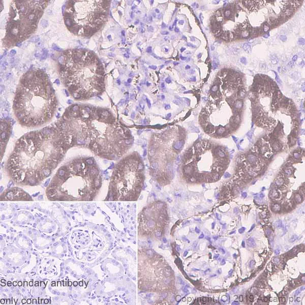 Immunohistochemistry (Formalin/PFA-fixed paraffin-embedded sections) - Anti-Aldolase B + Aldolase C antibody [EPR3138Y] (AB75751)