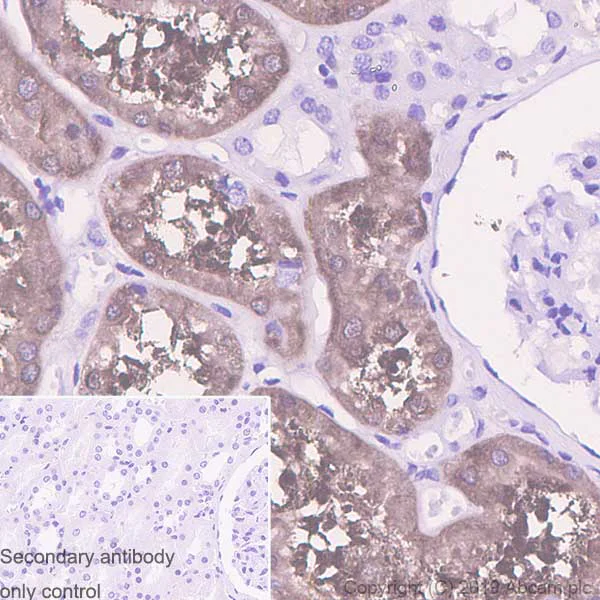 Immunohistochemistry (Formalin/PFA-fixed paraffin-embedded sections) - Anti-Aldolase B + Aldolase C antibody [EPR3138Y] (AB75751)