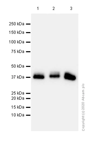 Western blot - Anti-Aldolase B + Aldolase C antibody [EPR3138Y] (AB75751)