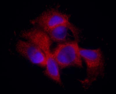 Immunocytochemistry/ Immunofluorescence - Anti-Aldolase B antibody [5E2AD2] (AB129728), expandable thumbnail