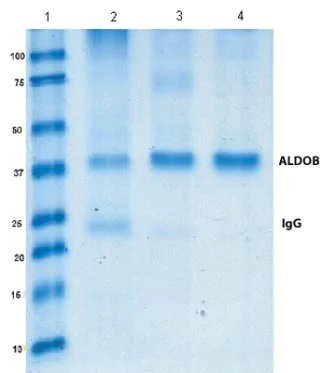 Immunoprecipitation - Anti-Aldolase B antibody [5E2AD2] (AB129728)