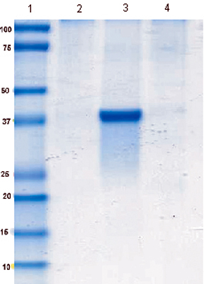 Immunoprecipitation - Anti-Aldolase B antibody [5E2AD2] (AB129728), expandable thumbnail
