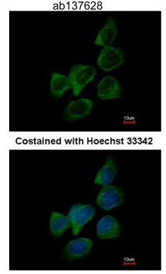 Immunocytochemistry/ Immunofluorescence - Anti-Aldolase B antibody (AB137628)
