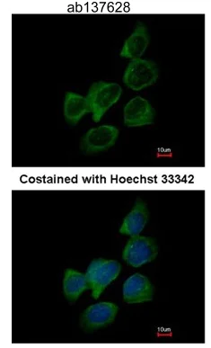 Immunocytochemistry/ Immunofluorescence - Anti-Aldolase B antibody (AB137628)