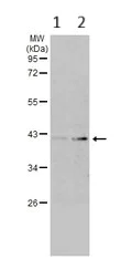 Western blot - Anti-Aldolase B antibody (AB137628)