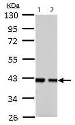 Western blot - Anti-Aldolase B antibody (AB137628)