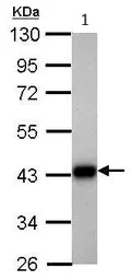 Western blot - Anti-Aldolase B antibody (AB137628)