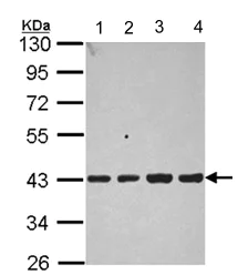 Western blot - Anti-Aldolase B antibody (AB137628)